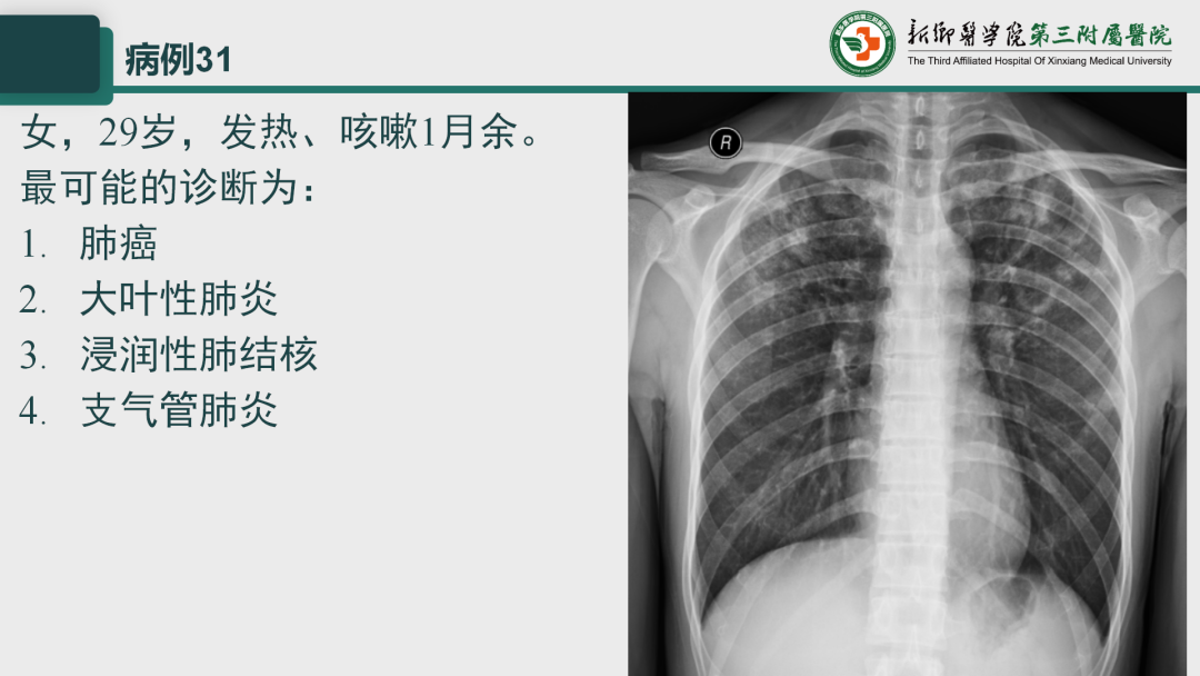 影像PPT - 【PPT】执业医师技能考试 影像篇·病例实训-39