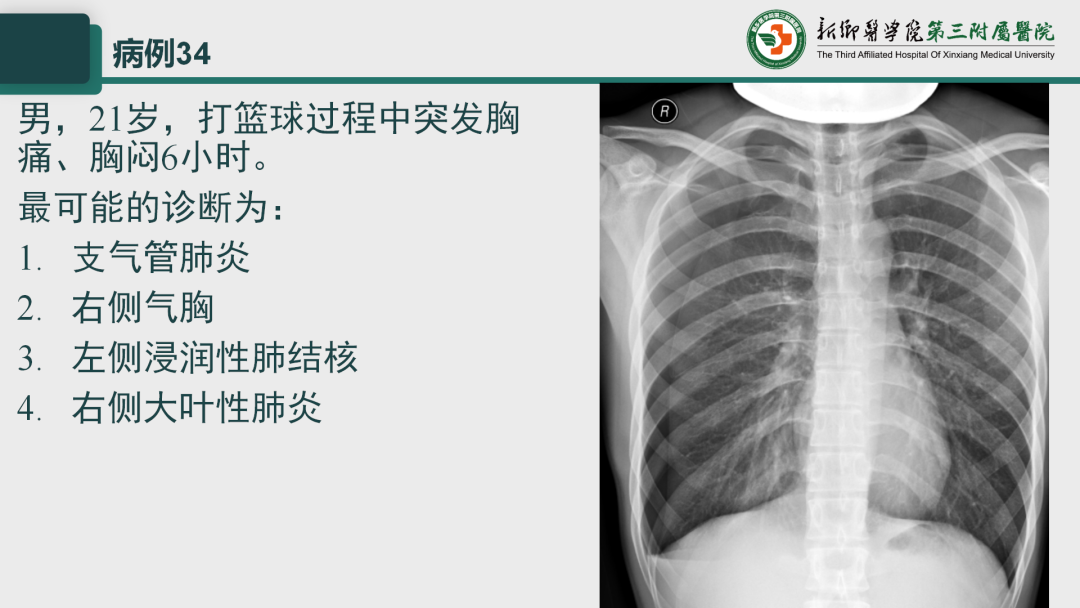 影像PPT - 【PPT】执业医师技能考试 影像篇·病例实训-42