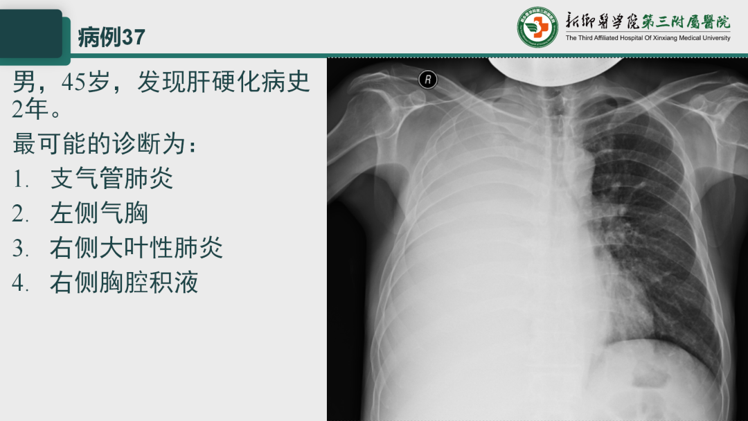 影像PPT - 【PPT】执业医师技能考试 影像篇·病例实训-45