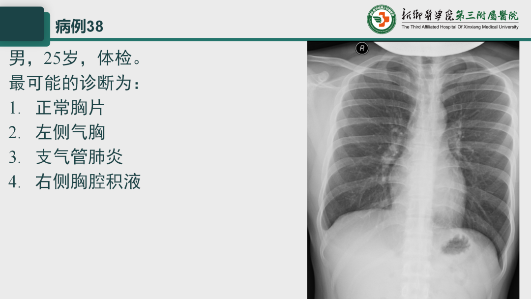 影像PPT - 【PPT】执业医师技能考试 影像篇·病例实训-46