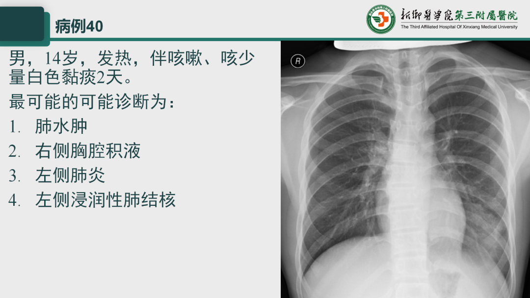 影像PPT - 【PPT】执业医师技能考试 影像篇·病例实训-48