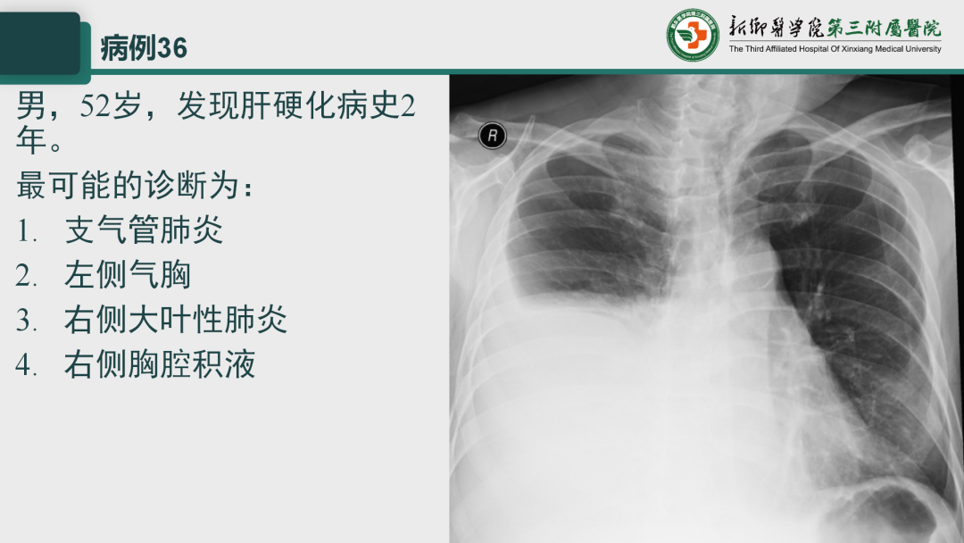 影像PPT - 【PPT】执业医师技能考试 影像篇·病例实训-44