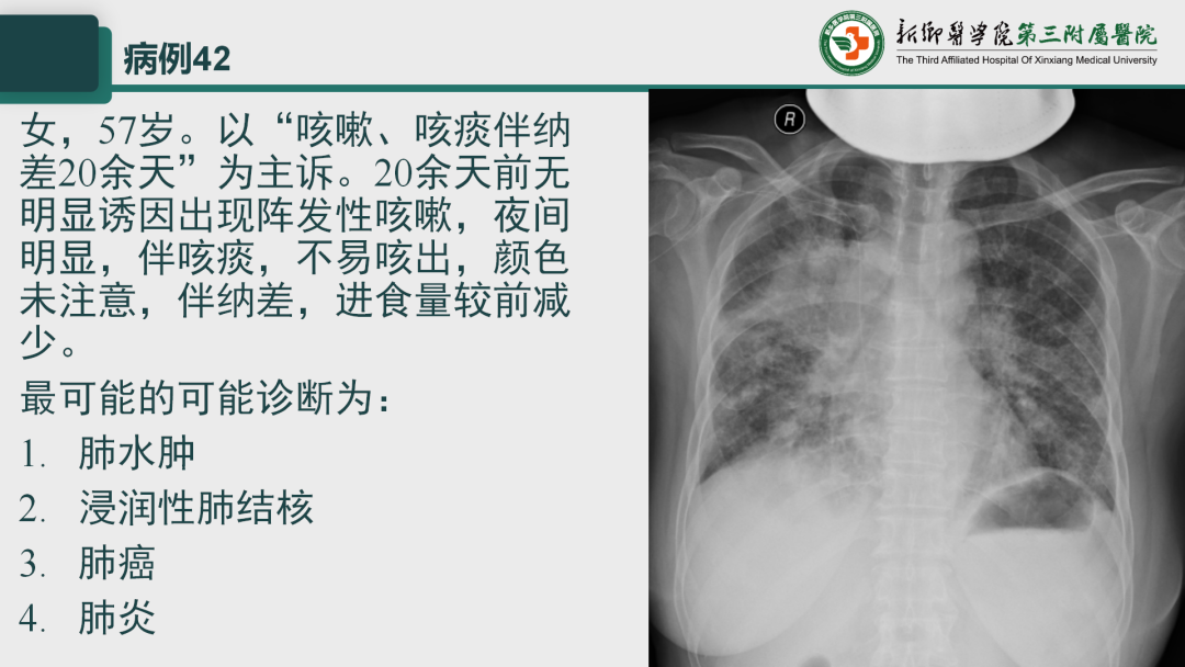 影像PPT - 【PPT】执业医师技能考试 影像篇·病例实训-50