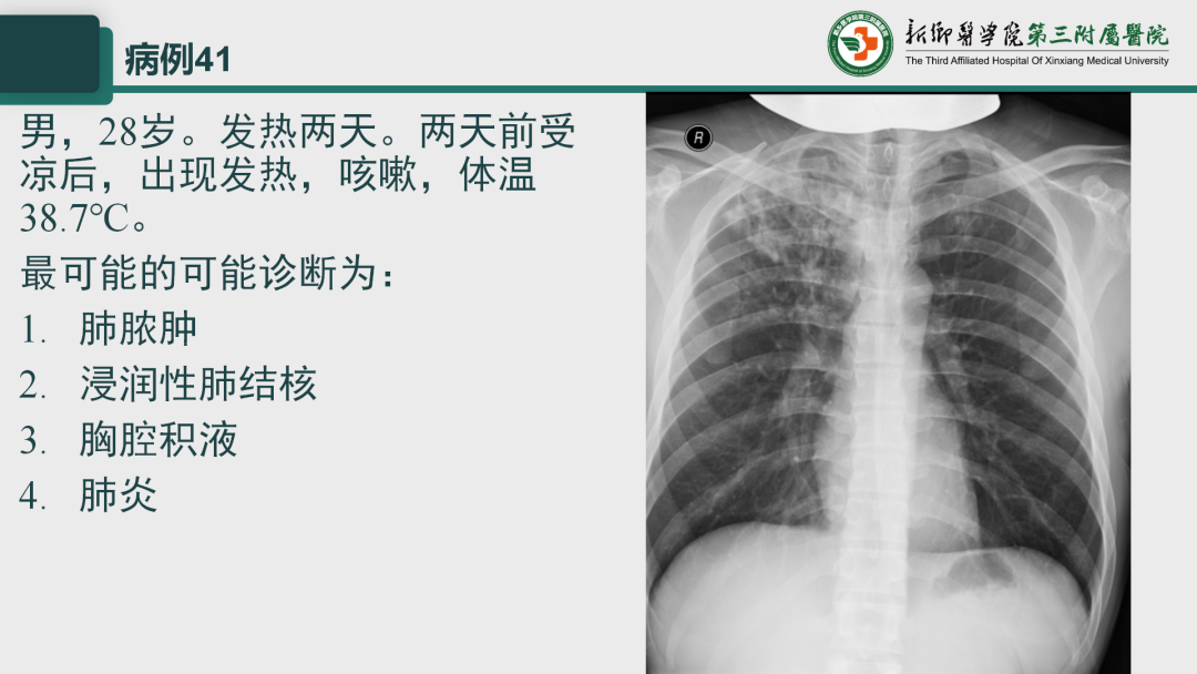 影像PPT - 【PPT】执业医师技能考试 影像篇·病例实训-49