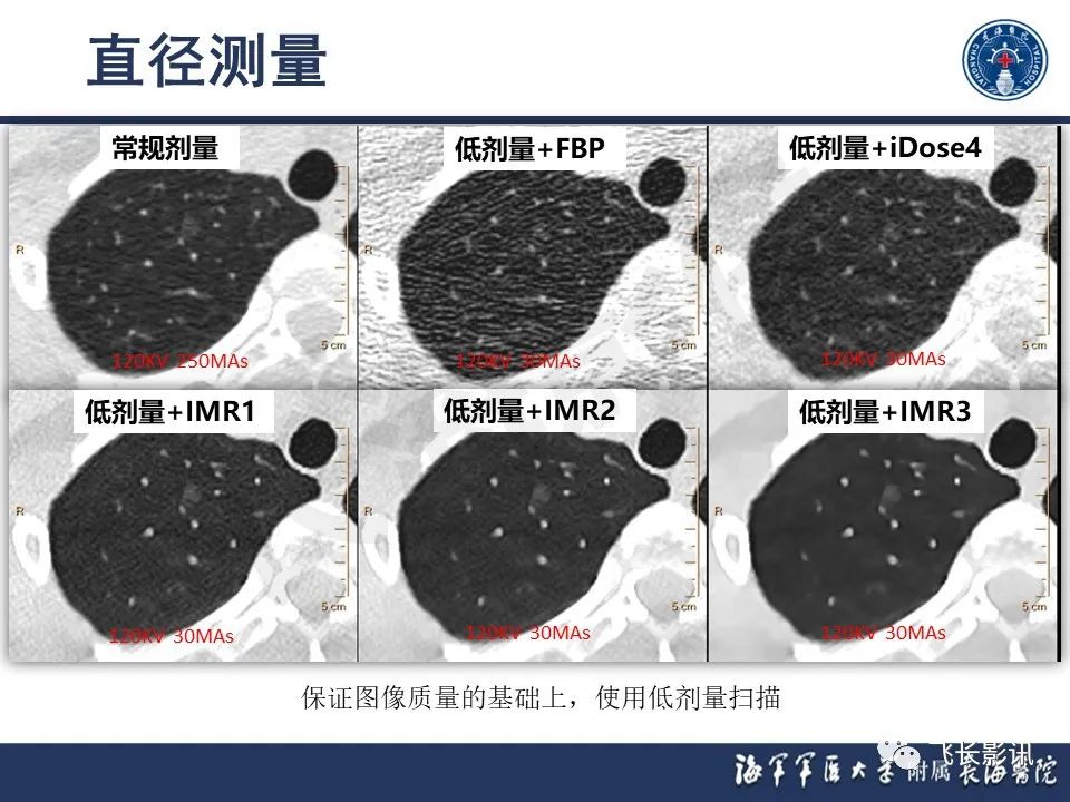 影像PPT - 【PPT】肺结节的CT定量测量-6