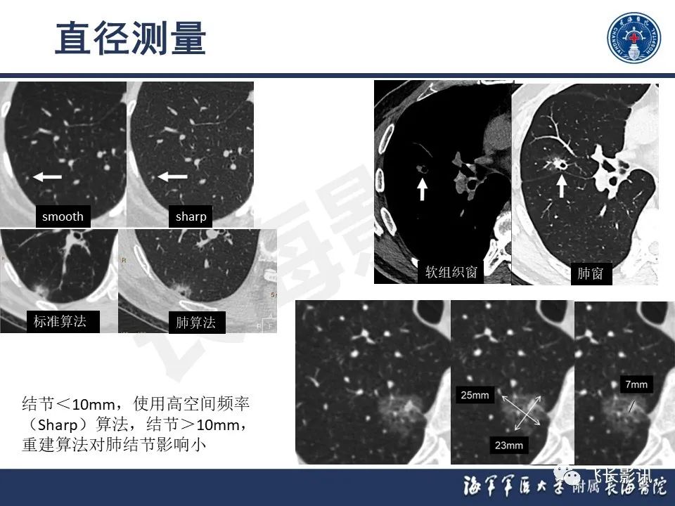 影像PPT - 【PPT】肺结节的CT定量测量-7