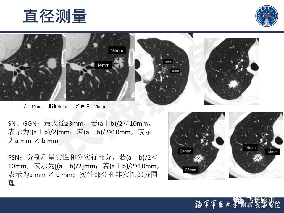 影像PPT - 【PPT】肺结节的CT定量测量-8
