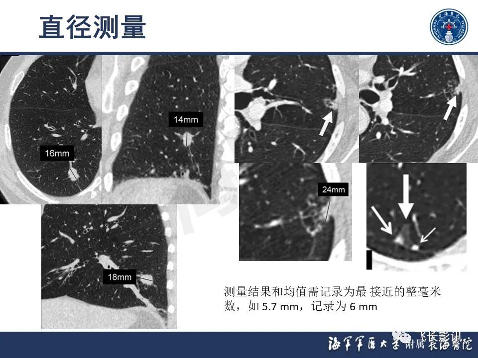 影像PPT - 【PPT】肺结节的CT定量测量-9