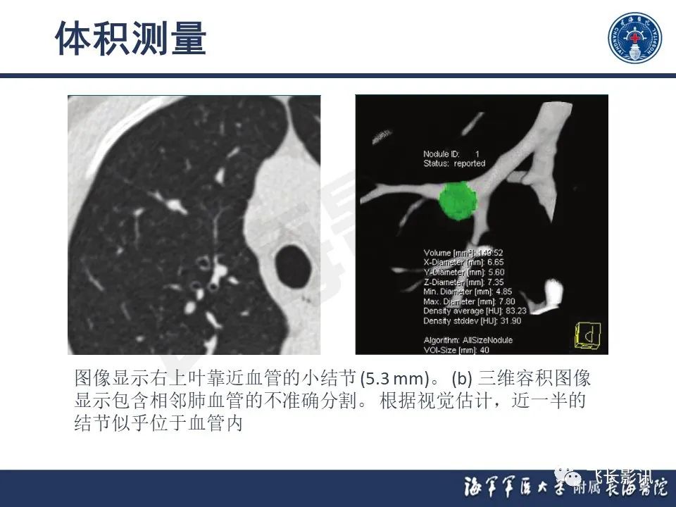 影像PPT - 【PPT】肺结节的CT定量测量-16