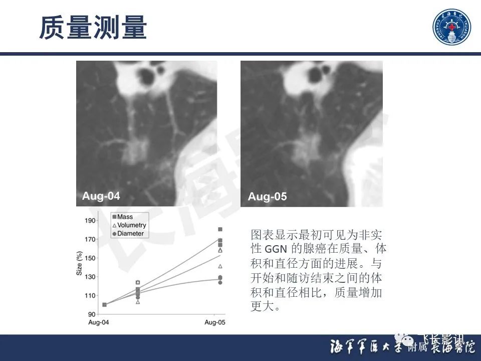 影像PPT - 【PPT】肺结节的CT定量测量-24