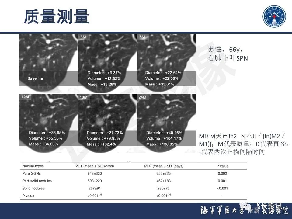 影像PPT - 【PPT】肺结节的CT定量测量-26