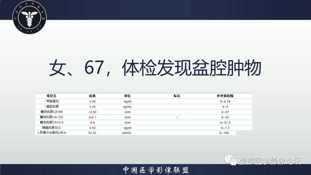 影像PPT - 【病例】卵巢甲状腺肿1里MR影像-2
