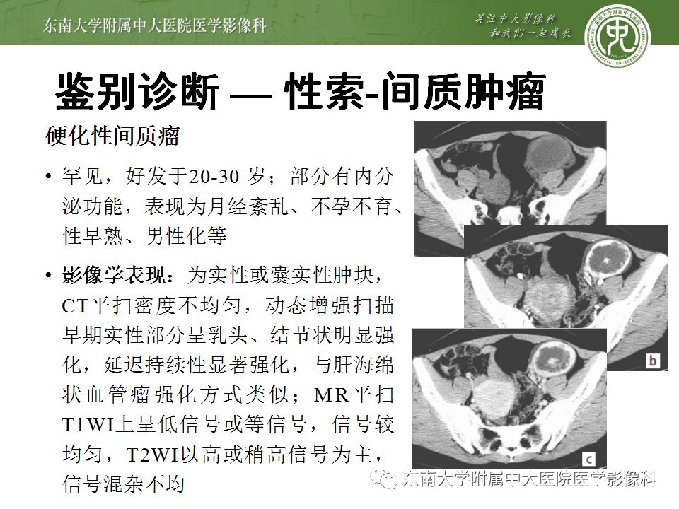 影像PPT - 【病例】卵巢甲状腺肿1里MR影像-29