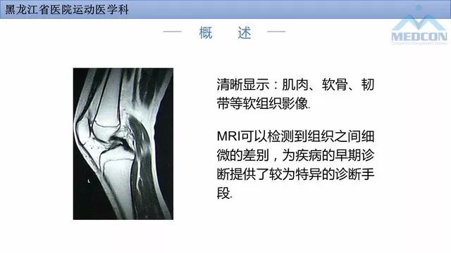 影像PPT - 【PPT】膝关节损伤的MR检查-2