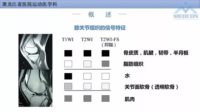 影像PPT - 【PPT】膝关节损伤的MR检查-5