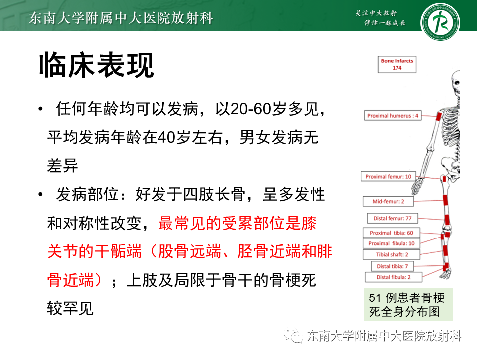 影像PPT - 【PPT】骨梗死的影像诊断-8 影像PPT - 【PPT】骨梗死的影像诊断-8