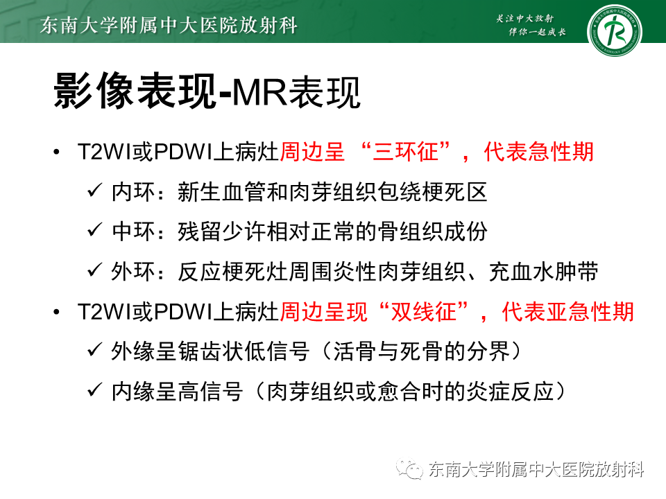 影像PPT - 【PPT】骨梗死的影像诊断-15 影像PPT - 【PPT】骨梗死的影像诊断-15