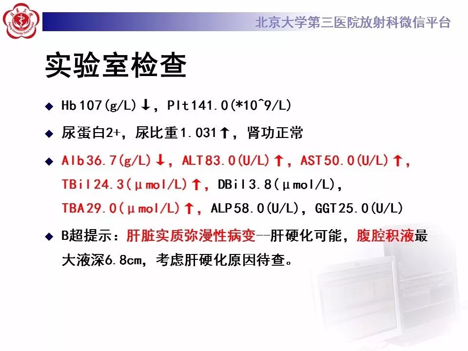 影像PPT - 【PPT】布-加综合征-4