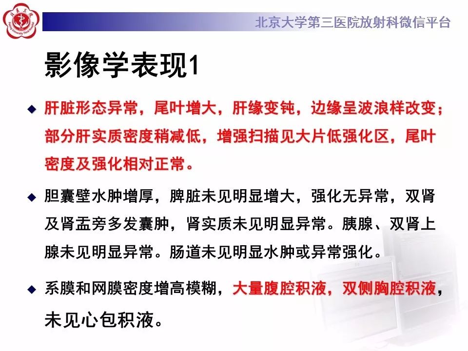 影像PPT - 【PPT】布-加综合征-9