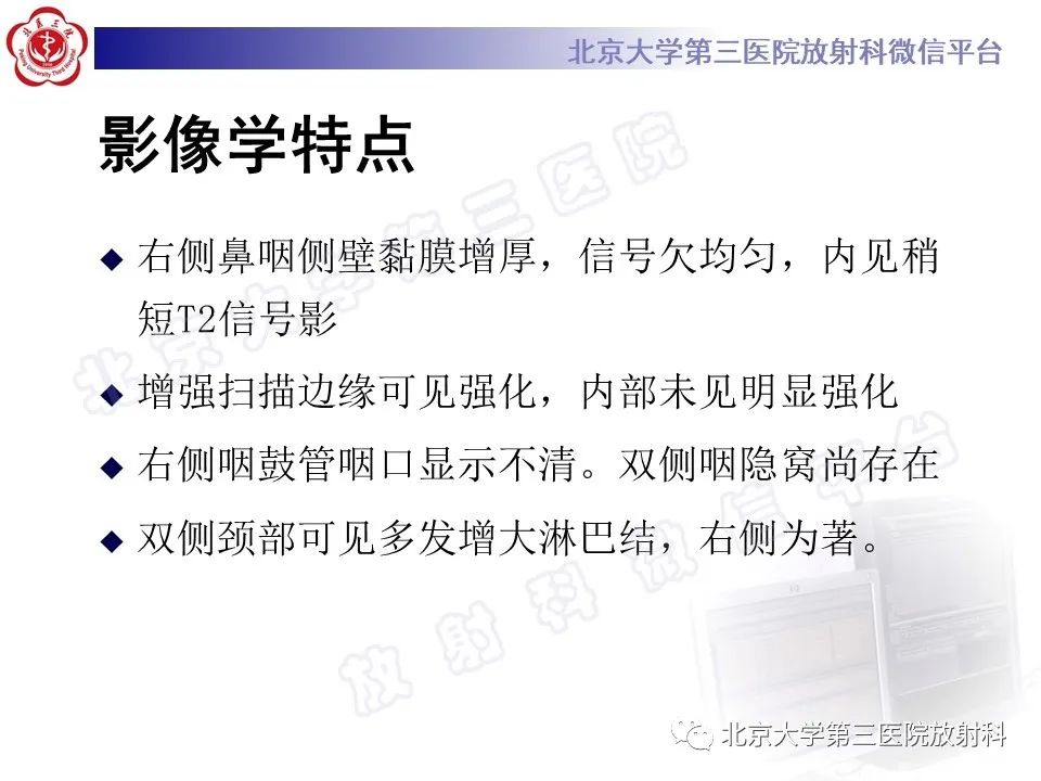 影像PPT - 【PPT】鼻咽结核-6