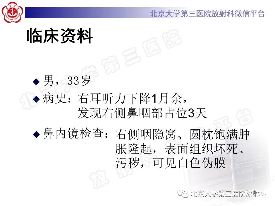 影像PPT - 【PPT】鼻咽结核-2