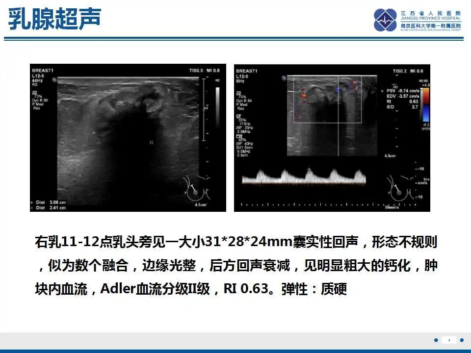 影像PPT - 【PPT】乳腺原发性骨肉瘤-3