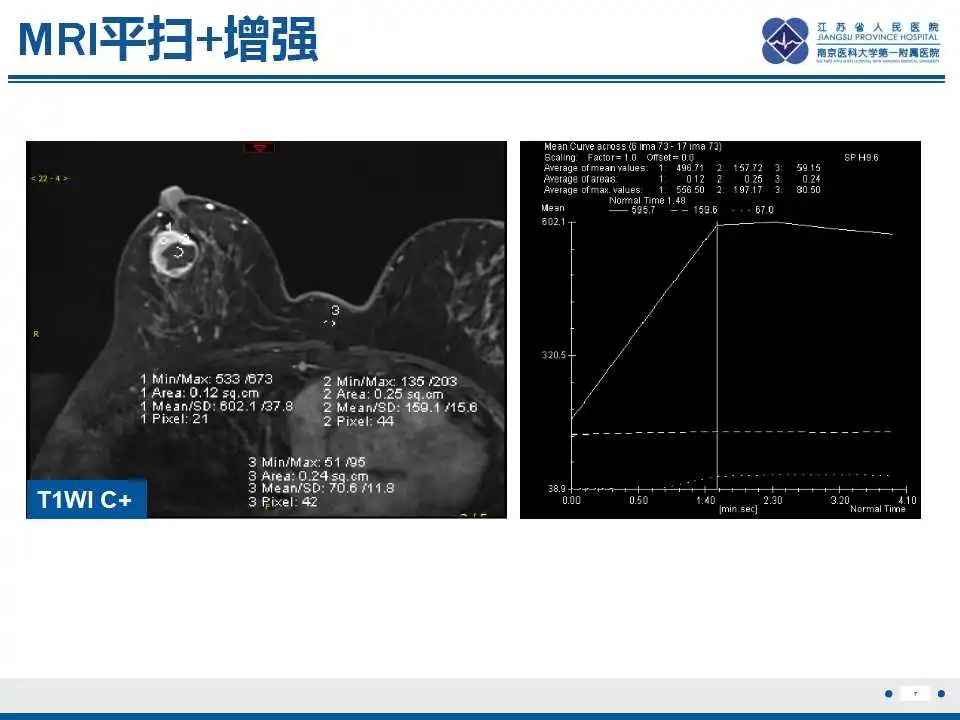 影像PPT - 【PPT】乳腺原发性骨肉瘤-8