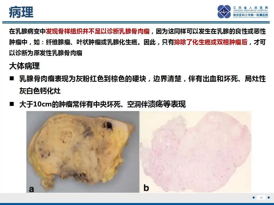 影像PPT - 【PPT】乳腺原发性骨肉瘤-24
