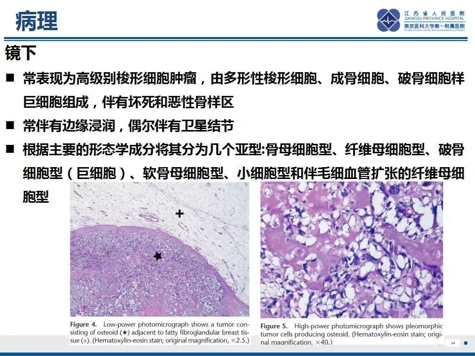 影像PPT - 【PPT】乳腺原发性骨肉瘤-25