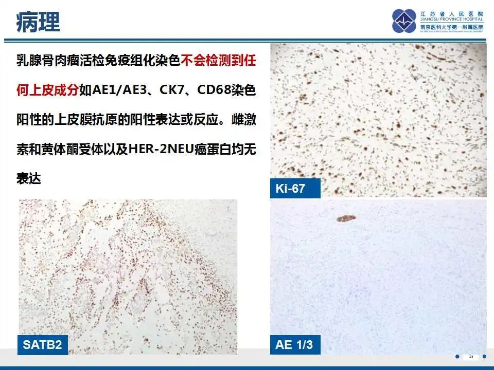 影像PPT - 【PPT】乳腺原发性骨肉瘤-26