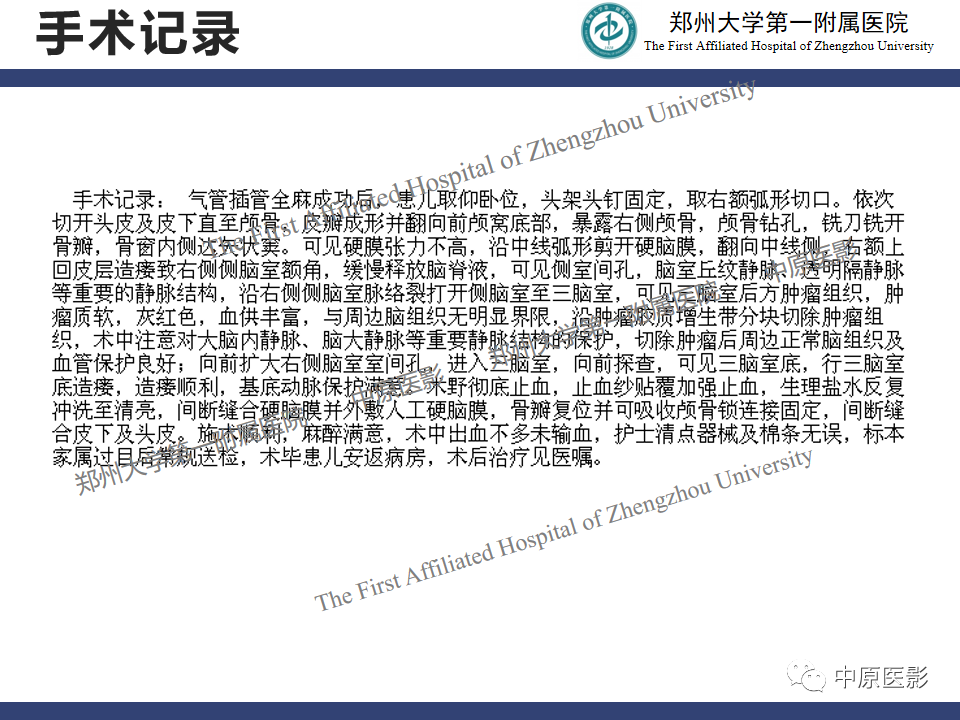 影像PPT - 【病例】松果体母细胞瘤1例CT及MR影像-10