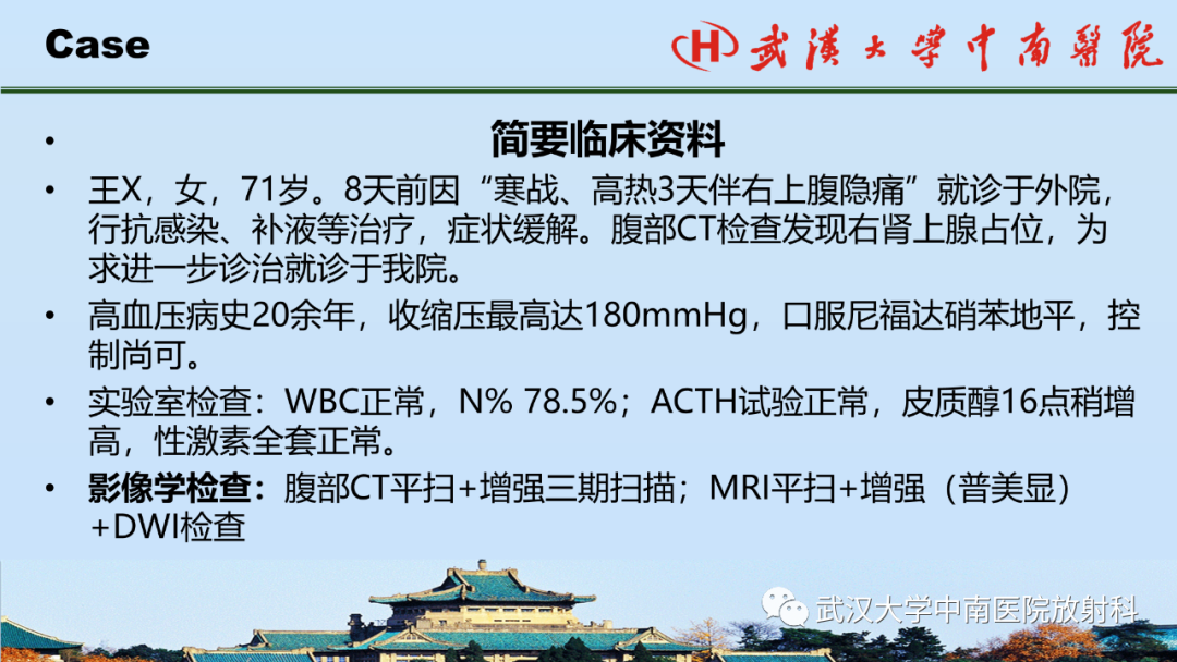影像PPT - 【PPT】腹盆病例讨论（肾上腺）-2