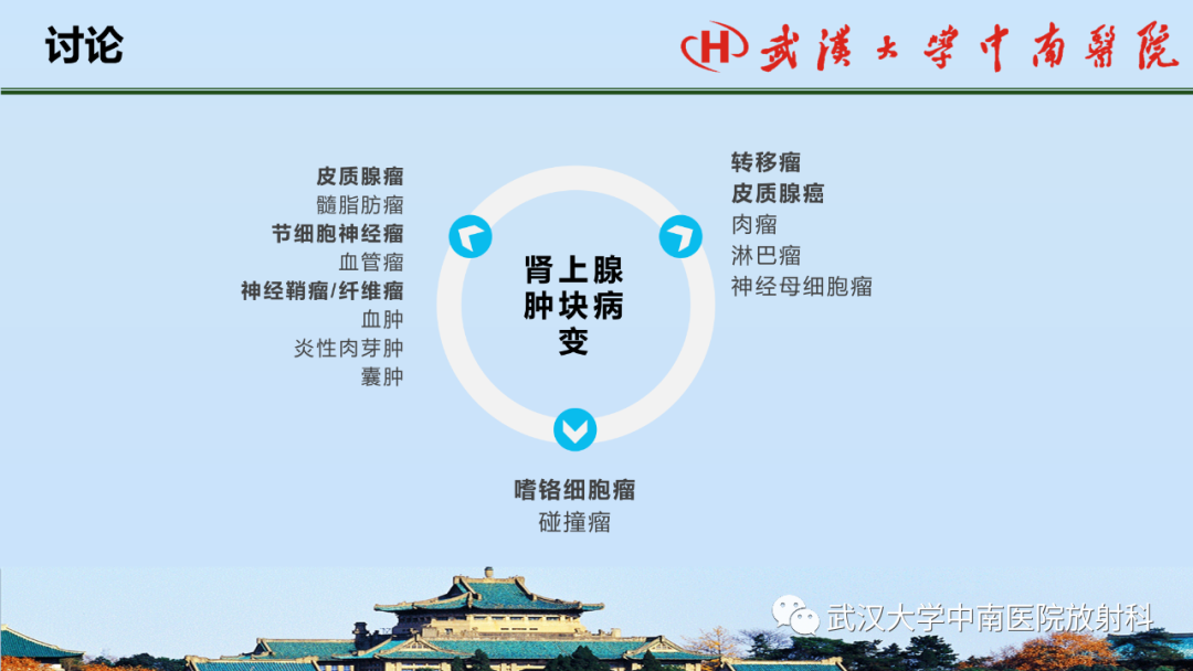 影像PPT - 【PPT】腹盆病例讨论（肾上腺）-17