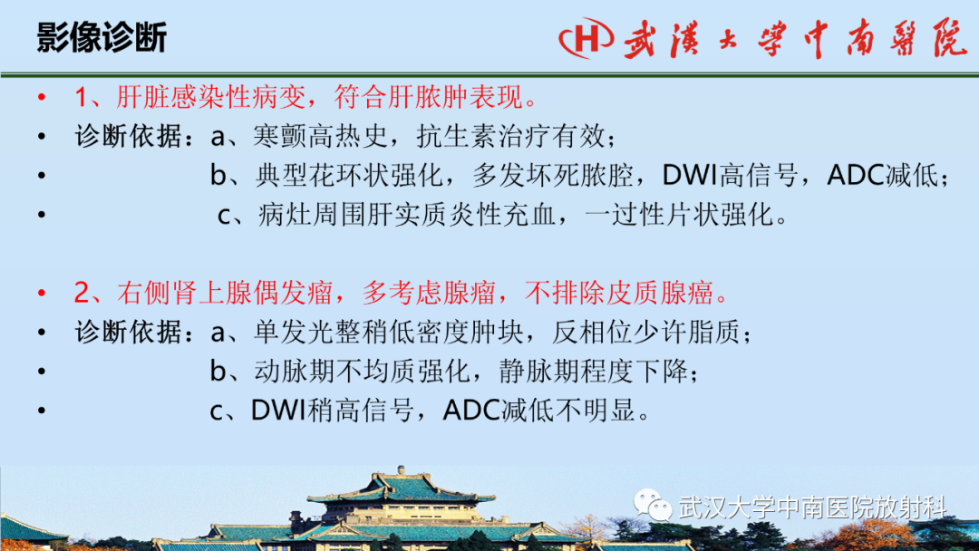 影像PPT - 【PPT】腹盆病例讨论（肾上腺）-14