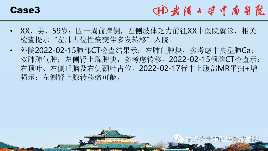 影像PPT - 【PPT】腹盆病例讨论（肾上腺）-21