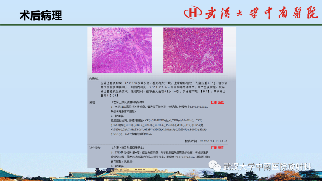 影像PPT - 【PPT】腹盆病例讨论（肾上腺）-37