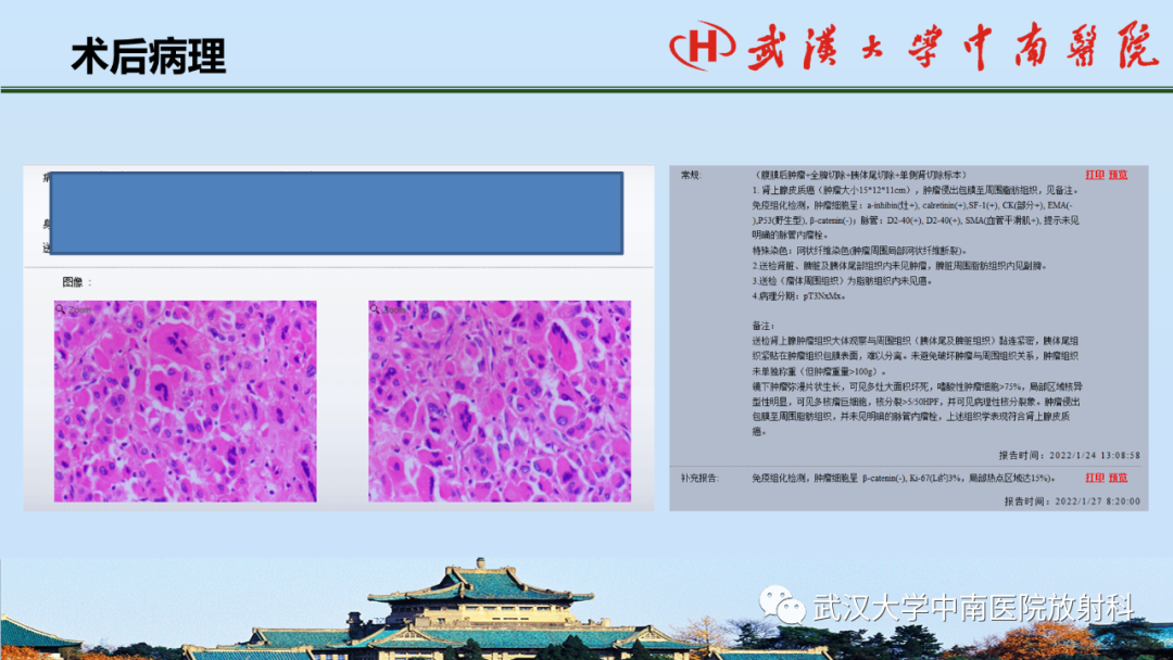 影像PPT - 【PPT】腹盆病例讨论（肾上腺）-35