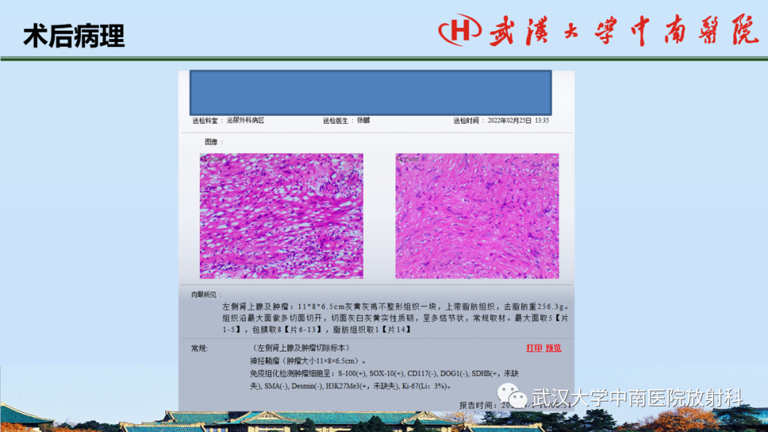 影像PPT - 【PPT】腹盆病例讨论（肾上腺）-1