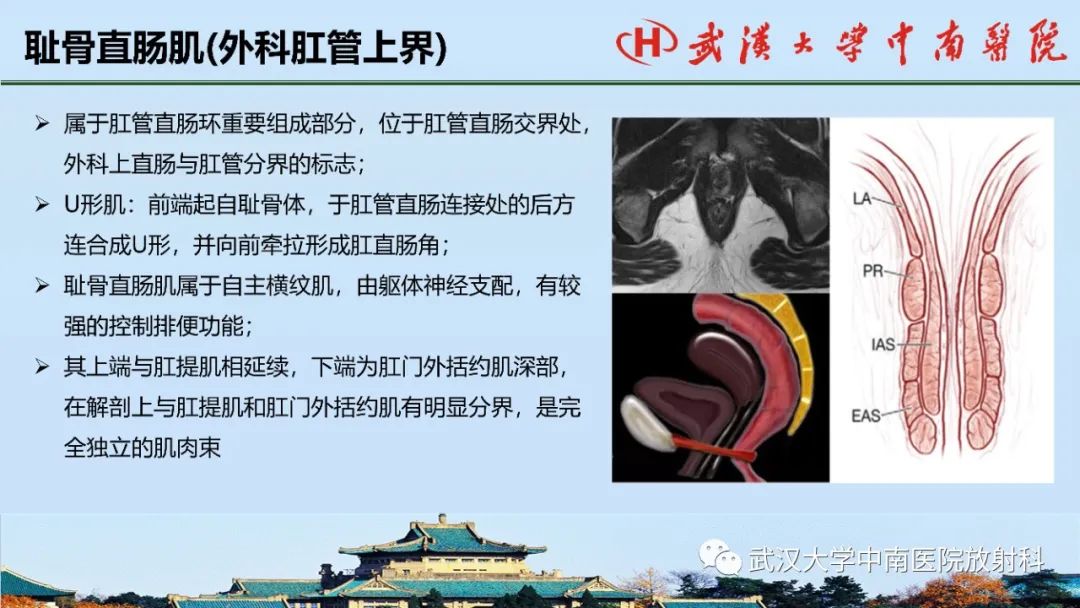 影像PPT - 【PPT】肛瘘的MRI成像与诊断-6