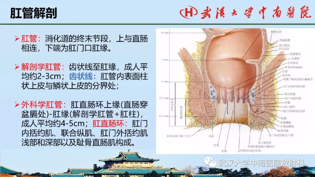 影像PPT - 【PPT】肛瘘的MRI成像与诊断-3