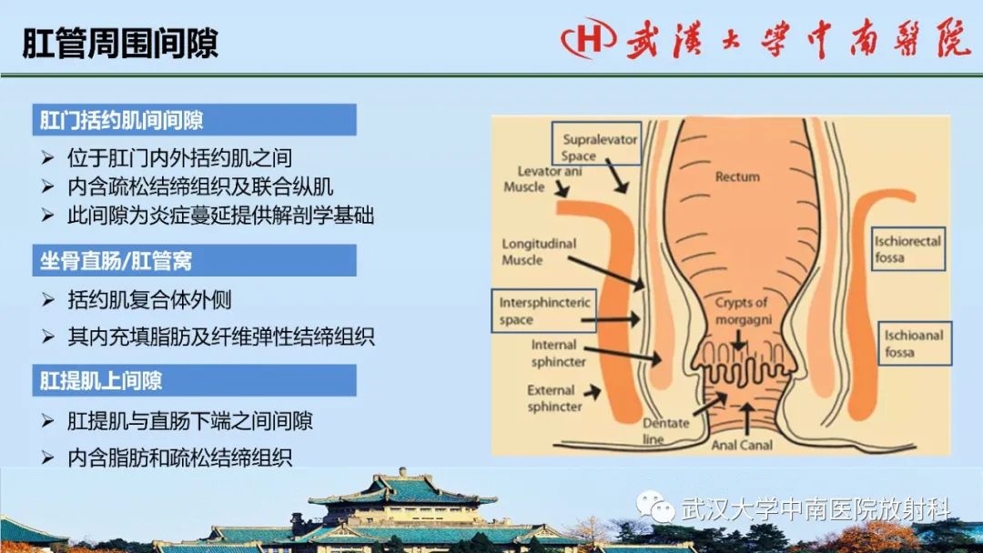 影像PPT - 【PPT】肛瘘的MRI成像与诊断-7