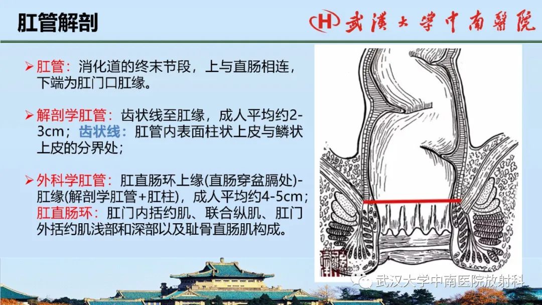 影像PPT - 【PPT】肛瘘的MRI成像与诊断-4
