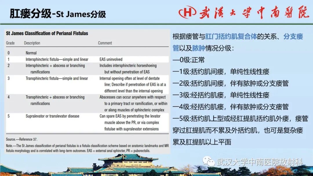 影像PPT - 【PPT】肛瘘的MRI成像与诊断-17