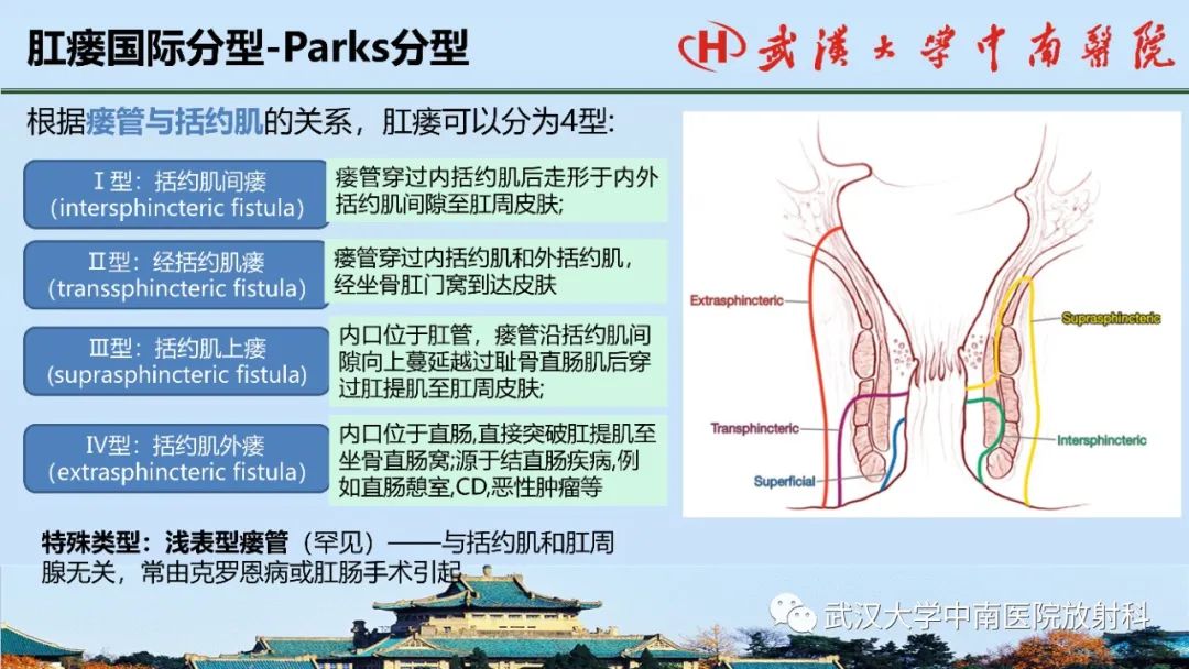 影像PPT - 【PPT】肛瘘的MRI成像与诊断-14