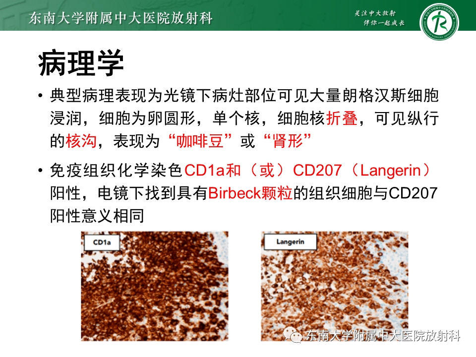 影像PPT - 【PPT】朗格汉斯细胞组织细胞增生症-10 影像PPT - 【PPT】朗格汉斯细胞组织细胞增生症-10