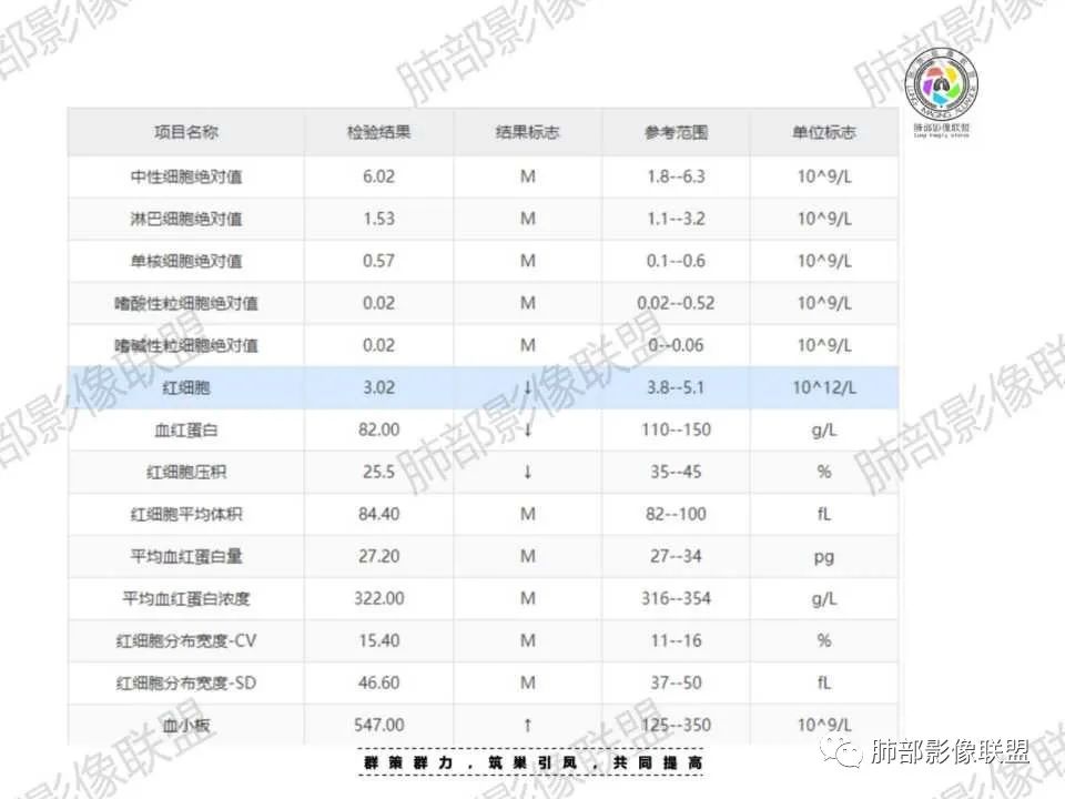 影像PPT - 【病例】胸椎旁病变伴骨破坏,肺内还是肺外?恶性还是良性?-3 影像PPT - 【病例】胸椎旁病变伴骨破坏,肺内还是肺外?恶性还是良性?-3