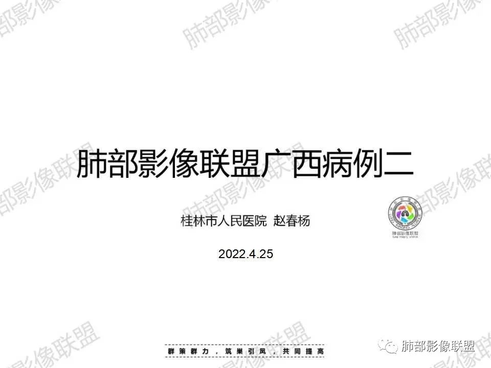 影像PPT - 【病例】胸椎旁病变伴骨破坏,肺内还是肺外?恶性还是良性?-1 影像PPT - 【病例】胸椎旁病变伴骨破坏,肺内还是肺外?恶性还是良性?-1