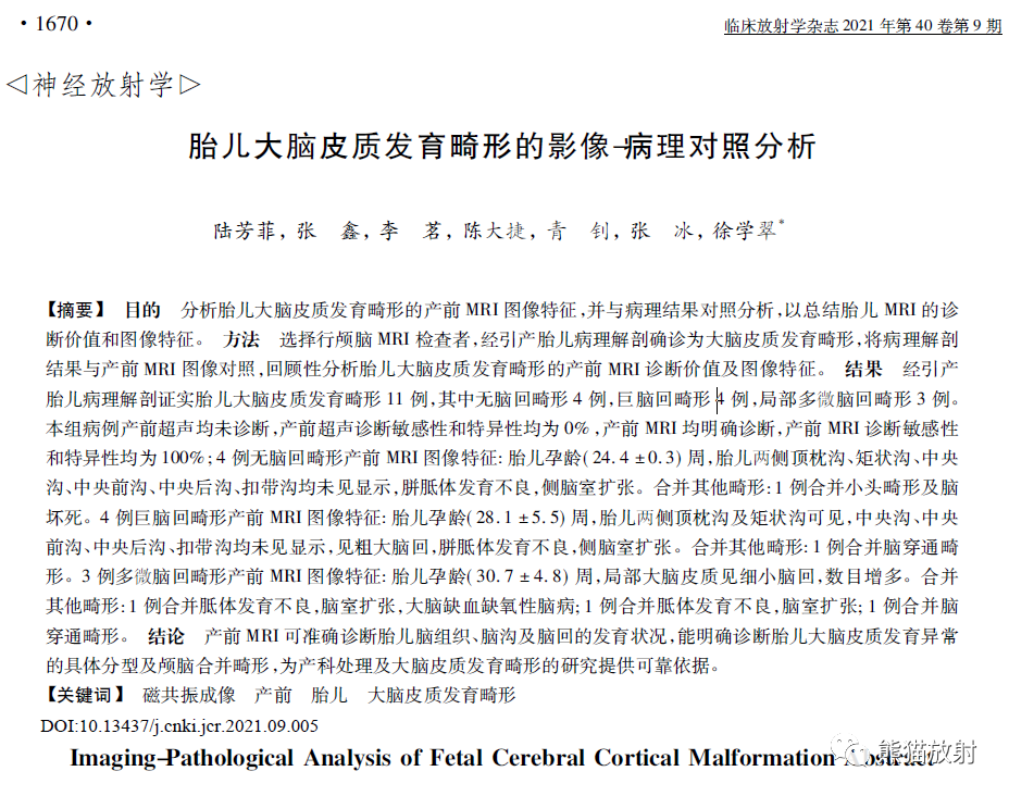 影像PPT - 产前胎儿大脑皮质发育畸形MRI诊断-7 影像PPT - 产前胎儿大脑皮质发育畸形MRI诊断-7