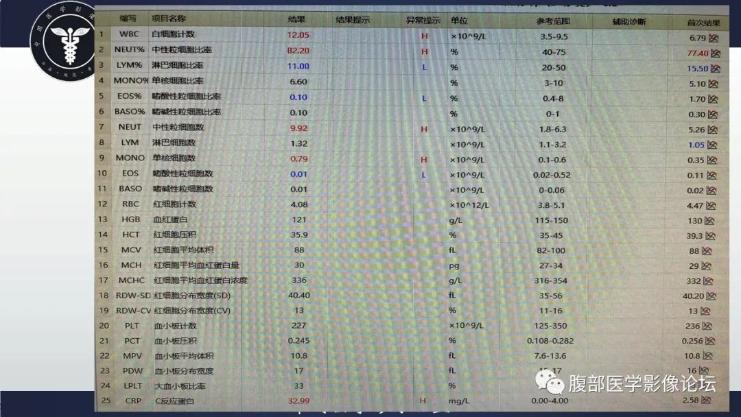 影像PPT - 【病例】肿块型胰腺炎1例CT影像诊断-4