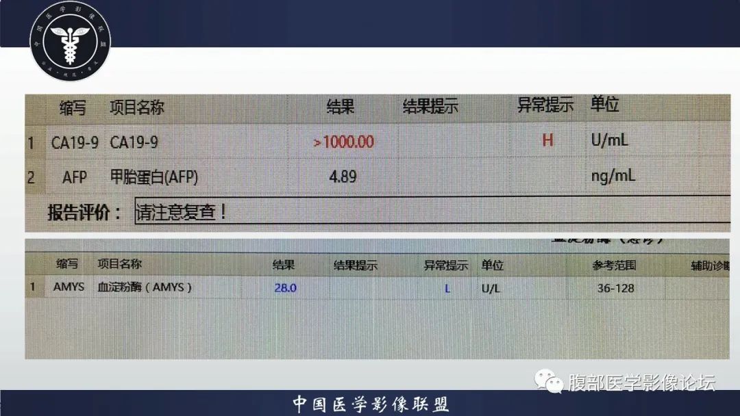 影像PPT - 【病例】肿块型胰腺炎1例CT影像诊断-3